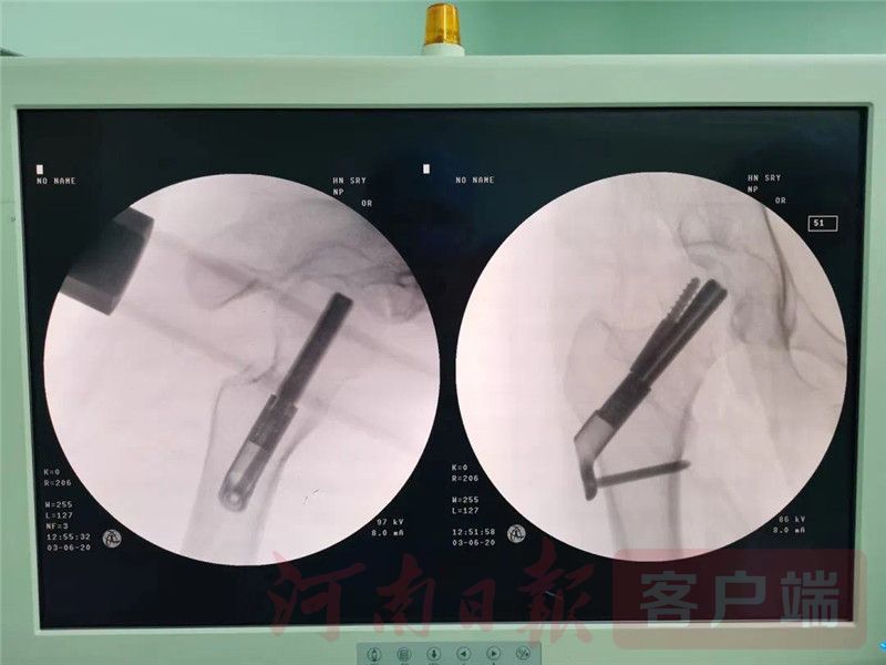 机器人医生来了！辅助诊断、精准开刀、对症下药……(图2)